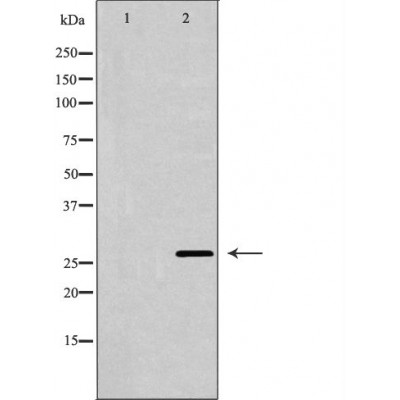 Western blot analysis of MCF7 cell lysate, using GZMB Antibody. The lane on the left is treated with the antigen-specific peptide.