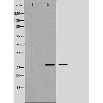 Western blot analysis of A549 whole cell lysates, using YWHAQ Antibody. The lane on the left is treated with the antigen-specific peptide.
