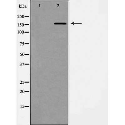 Western blot analysis of extracts of A549 lysate, using ABCC1antibody. The lane on the left is treated with the antigen-specific peptide.