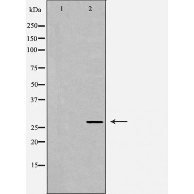 Western blot analysis of extracts of Jurkat,, using YWHAG antibody. The lane on the left is treated with the antigen-specific peptide.