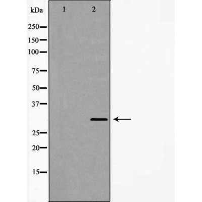 Western blot analysis of MCF7 cell lysate, using GCLM Antibody. The lane on the left is treated with the antigen-specific peptide.