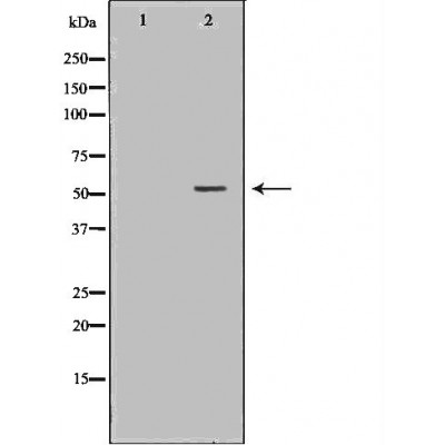 Western blot analysis of Mouse brain lysate, using HTR3A Antibody. The lane on the left is treated with the antigen-specific peptide.