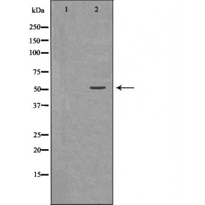 Western blot analysis of Mouse liver tissue lysates, using HTR2B Antibody. The lane on the left is treated with the antigen-specific peptide.
