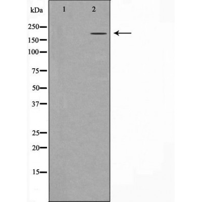 Western blot analysis of extracts of A431 , using TP53BP1 antibody. The lane on the left is treated with the antigen-specific peptide.