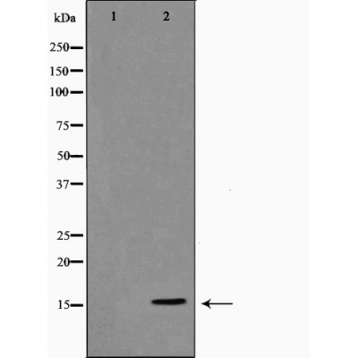 Western blot analysis of with Histone H3 Mouse mAb diluted at 1:5,000.