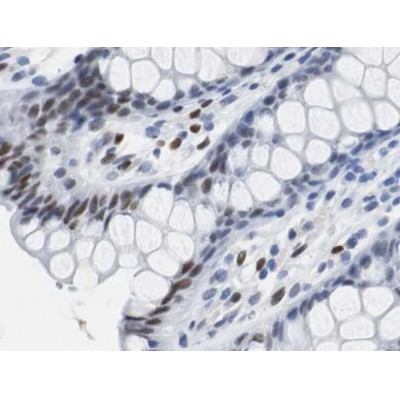 AF6090 at 1/100 staining human colon tissues sections by IHC-P. The tissue was formaldehyde fixed and a heat mediated antigen retrieval step in citrate buffer was performed. The tissue was then blocked and incubated with the antibody for 1.5 hours at113�