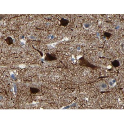 AF5156 at 1/100 dilution staining MAP2 in human brain by Immunohistochemistry using paraffin-embedded tissue