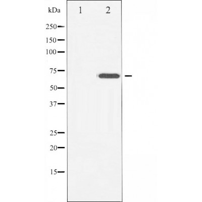 Western blot analysis of ABCG2 expression in HT-29 cells,The lane on the left is treated with the antigen-specific peptide.