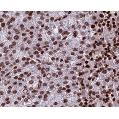 Histone H3 Antibody for IHC in human testis