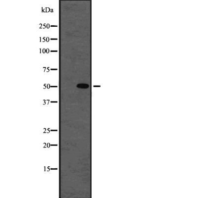 Western blot analysis of beta I Tubulin using K562 whole cell lysates