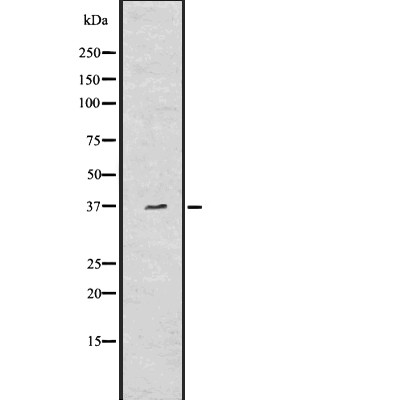 Western blot analysis of Aquaporin 7 using Jurkat whole lysates.