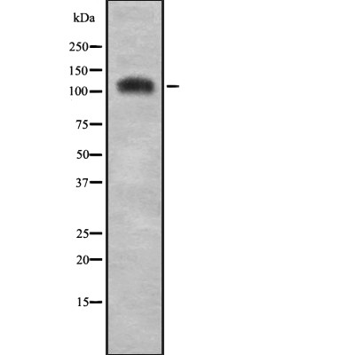 Western blot analysis of C/EBP ? using COLO205 whole cell lysates