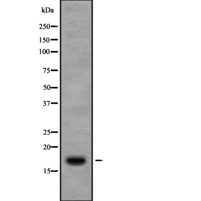 Western blot analysis of Ribosomal Protein S13 using 3T3 whole cell lysates