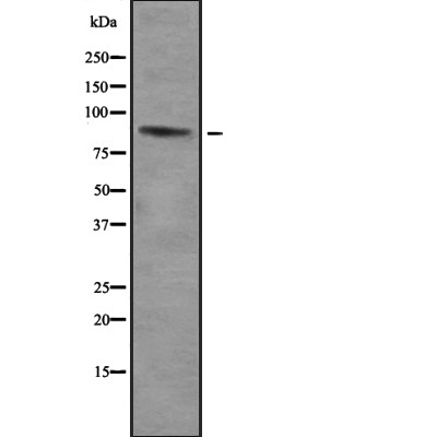 Western blot analysis of ZNF785 using HepG2 whole cell lysates