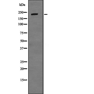 Western blot analysis of TJP1 expression in HEK293 cells ,The lane on the left is treated with the antigen-specific peptide.