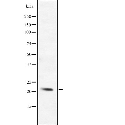 Western blot analysis of BCL2L10 expression in ; HepG2 cell lysate,The lane on the left is treated with the antigen-specific peptide.