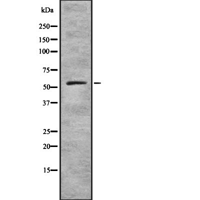 Western blot analysis of ZNF497 expression in HEK293 cells ,The lane on the left is treated with the antigen-specific peptide.