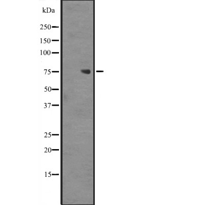 Western blot analysis of ZNF709 expression in Jurkat cell lysate,The lane on the left is treated with the antigen-specific peptide.
