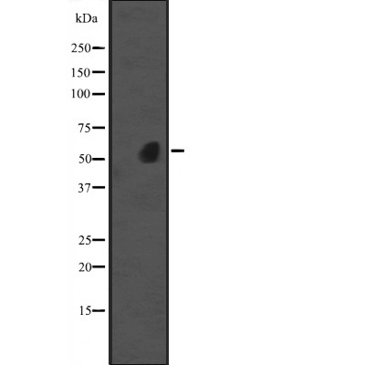 Western blot analysis of ZDHHC13 expression in Jurkat cell lysate ;,The lane on the left is treated with the antigen-specific peptide.