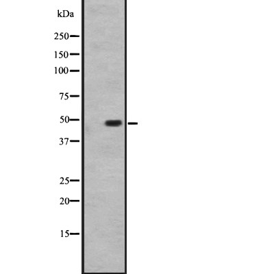 Western blot analysis of HTR1D expression in HEK293 cells ,The lane on the left is treated with the antigen-specific peptide.
