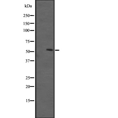 Western blot analysis of HTR3A expression in A431 whole cell lysate ,The lane on the left is treated with the antigen-specific peptide.