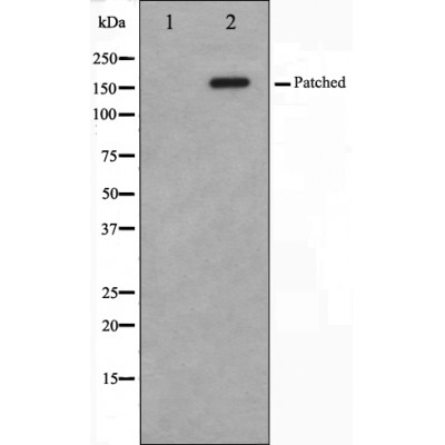 Western blot analysis of Patched expression in mouse muscle cells,The lane on the left is treated with the antigen-specific peptide.