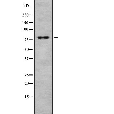 Western blot analysis of FAP 1 expression in LOVO cell extract
