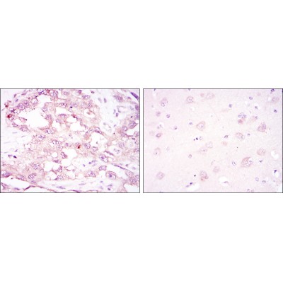  Immunohistochemical analysis of paraffin-embedded ovarian cancer (left) and brain tissues (right) using PRKAA1 mouse mAb with DAB staining.