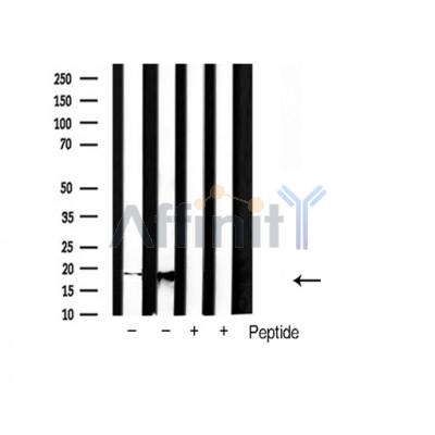Western blot analysis of SOD1 Antibody expression in rat brain and mouse brain tissues lysates.