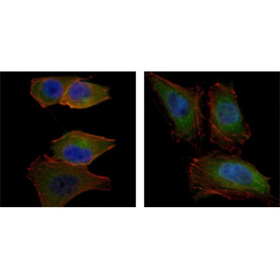  Immunofluorescence analysis of PANC-1 (left) and Hela (right) cells using AKT2 mouse mAb (green). Blue: DRAQ5 fluorescent DNA dye. Red: Actin filaments have been labeled with Alexa Fluor-555 phalloidin.