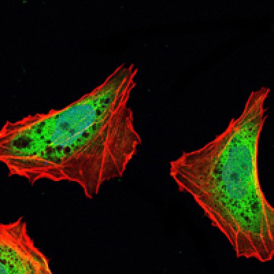 Immunofluorescence analysis of NTERA-2 cells using ATXN1 mouse mAb (green). Blue: DRAQ5 fluorescent DNA dye. Red: Actin filaments have been labeled with Alexa Fluor-555 phalloidin.