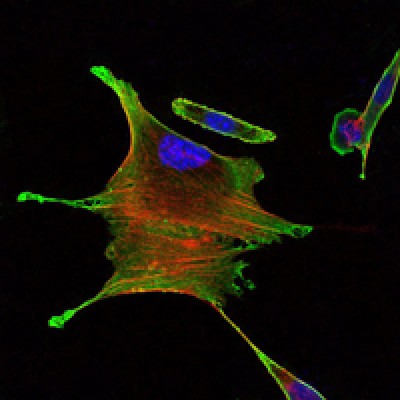 Immunofluorescence analysis of Eca109 cells using BMPR2 mouse mAb (green). Blue: DRAQ5 fluorescent DNA dye. Red: Actin filaments have been labeled with Alexa Fluor-555 phalloidin.
