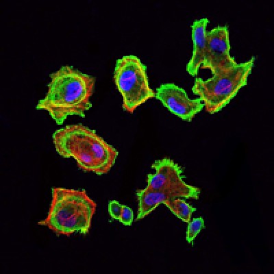 Immunofluorescence analysis of GC7901 cells using CDK5 mouse mAb (green). Blue: DRAQ5 fluorescent DNA dye. Red: Actin filaments have been labeled with Alexa Fluor-555 phalloidin. 