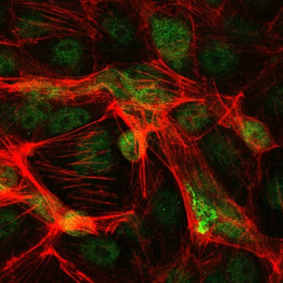 Immunofluorescence analysis of PC-2 cells using c-Jun mouse mAb (green). Red: Actin filaments have been labeled with Alexa Fluor-555 phalloidin. 