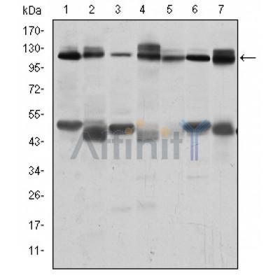  Western blot analysis using C-CBL mouse mAb against RAJI (1), RAW264.7 (2), K562 (3), SKBR-3 (4), 3T3-L1 (5), THP-1 (6) and PC-12 (7) cell lysate.