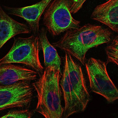  Immunofluorescence analysis of Hela cells using C-CBL mouse mAb (green). Blue: DRAQ5 fluorescent DNA dye. Red: Actin filaments have been labeled with Alexa Fluor-555 phalloidin.