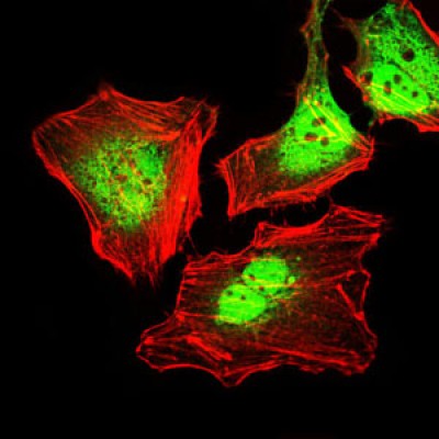  Immunofluorescence analysis of HeLa cells using CK5 mouse mAb (green). Red: Actin filaments have been labeled with Alexa Fluor-555 phalloidin. 