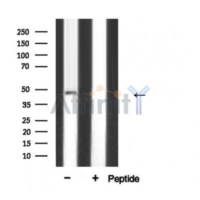 Western blot analysis of AP 2 expression in COLO205 cells