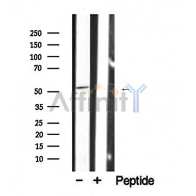 Western blot analysis of extracts of mouse muscle, using KRT7 antibody.
