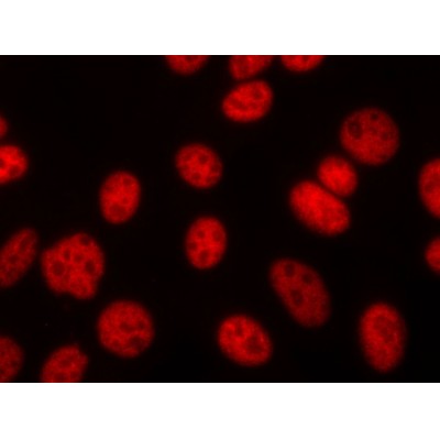 AF2006 staining lovo cells by ICC/IF. Cells were fixed with PFA and permeabilized in 0.1% saponin prior to blocking in 10% serum for 45 minutes at 37C.The primary antibody was diluted 1/400 and incubated with the sample for 1 hour at 37C.
