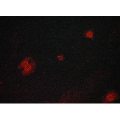AF2016 staining lovo cells by ICC/IF. Cells were fixed with PFA and permeabilized in 0.1% saponin prior to blocking in 10% serum for 45 minutes at 37C.The primary antibody was diluted 1/400 and incubated with the sample for 1 hour at 37C.