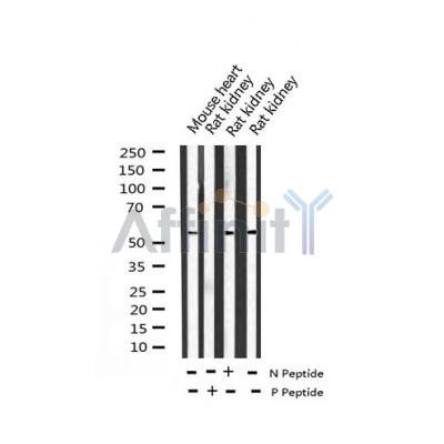 Western blot analysis of Phospho-ATF2 (Ser112 or 94) expression in various lysates