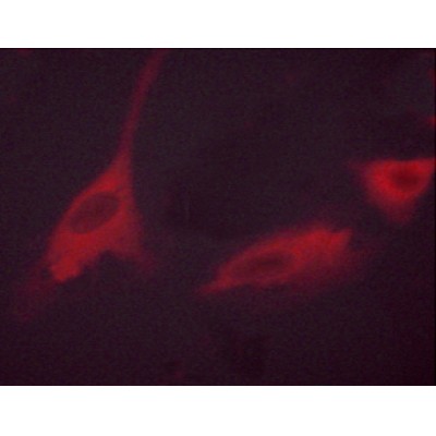 AF3228 staining 293 cells by ICC/IF. Cells were fixed with PFA and permeabilized in 0.1% saponin prior to blocking in 10% serum for 45 minutes at 37C.The primary antibody was diluted 1/400 and incubated with the sample for 1 hour at 37C.