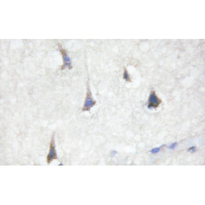 Immunohistochemical staining of paraffin embedded mouse liver with purified Phospho-STAT3 (Tyr705) Antibody at a working dilution of 1/100. The sample is counter-stained with hematoxylin. Antigen retrieval was perfomed using Tris-EDTA buffer, pH 9.0. 