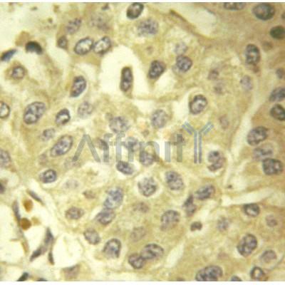 AF6245 at 1/100 staining human breast tissues sections by IHC-P. The tissue was formaldehyde fixed and a heat mediated antigen retrieval step in citrate buffer was performed. The tissue was then blocked and incubated with the antibody for 1.5 hours at 95