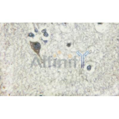 AF6276 at 1/100 staining human brain tissues sections by IHC-P. The tissue was formaldehyde fixed and a heat mediated antigen retrieval step in citrate buffer was performed. The tissue was then blocked and incubated with the antibody for 1.5 hours at 57��