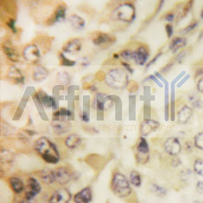 AF6356 at 1/100 staining human liver tissues sections by IHC-P. The tissue was formaldehyde fixed and a heat mediated antigen retrieval step in citrate buffer was performed. The tissue was then blocked and incubated with the antibody for 1.5 hours at136��