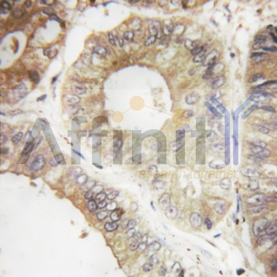 AF6357 at 1/100 staining human colon tissues sections by IHC-P. The tissue was formaldehyde fixed and a heat mediated antigen retrieval step in citrate buffer was performed. The tissue was then blocked and incubated with the antibody for 1.5 hours at117�