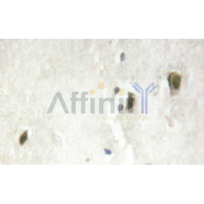AF6456 at 1/100 staining Human brain tissue sections by IHC-P. The tissue was formaldehyde fixed and a heat mediated antigen retrieval step in citrate buffer was performed.