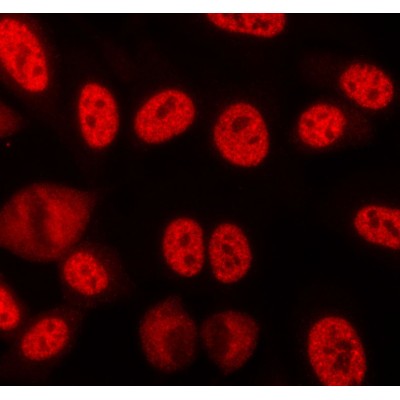 AF5161 staining lovo cells by ICC/IF. Cells were fixed with PFA and permeabilized in 0.1% saponin prior to blocking in 10% serum for 45 minutes at 37C.
